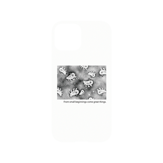 RHINOSHIELD X Incrediville  Mod NX iPhone 13 mini Case - Microscopic Observation - White Backplate