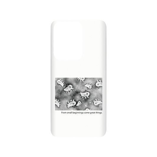 RHINOSHIELD X Incrediville  SolidSuit Samsung Galaxy S20 Ultra (4G/5G) Case - Microscopic Observation - White