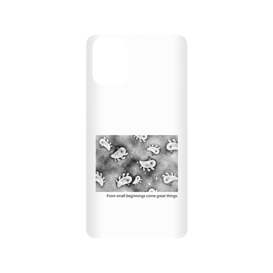 RHINOSHIELD X Incrediville  SolidSuit Samsung Galaxy A51 (4G) Case - Microscopic Observation - White