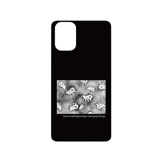 RHINOSHIELD X Incrediville  SolidSuit Samsung Galaxy A51 (4G) Case - Microscopic Observation - Black