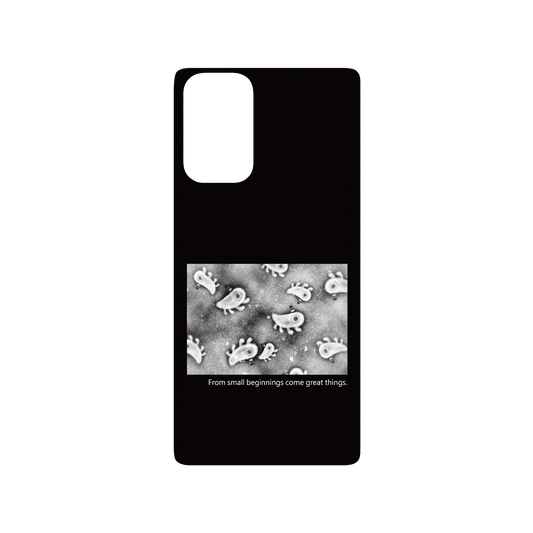 RHINOSHIELD X Incrediville  SolidSuit Samsung Galaxy Note20 (4G/5G) Case - Microscopic Observation - Black