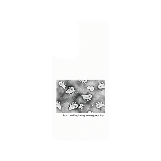 RHINOSHIELD X Incrediville  SolidSuit Samsung Galaxy A53 Case - Microscopic Observation - White
