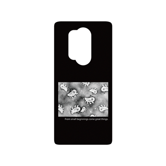 RHINOSHIELD X Incrediville  SolidSuit OnePlus 8 Pro Case - Microscopic Observation - Black