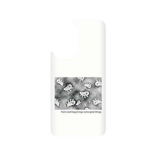 RHINOSHIELD X Incrediville  SolidSuit OnePlus 9 Case - Microscopic Observation - White