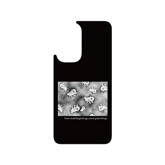 RHINOSHIELD X Incrediville  SolidSuit OnePlus 9 Case - Microscopic Observation - Black