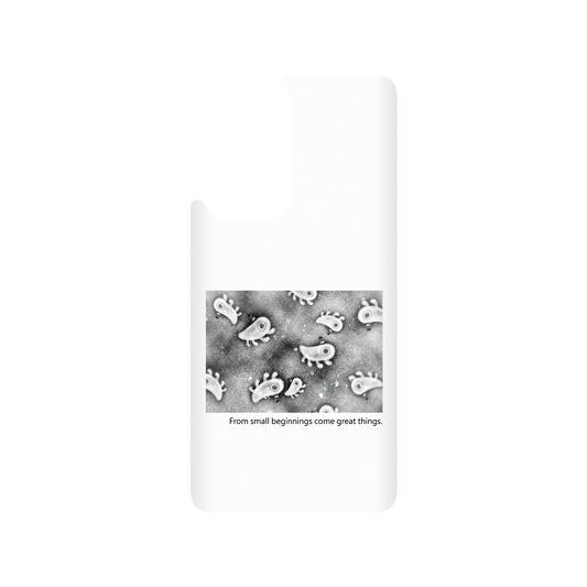 RHINOSHIELD X Incrediville  SolidSuit OnePlus 9 Pro Case - Microscopic Observation - White