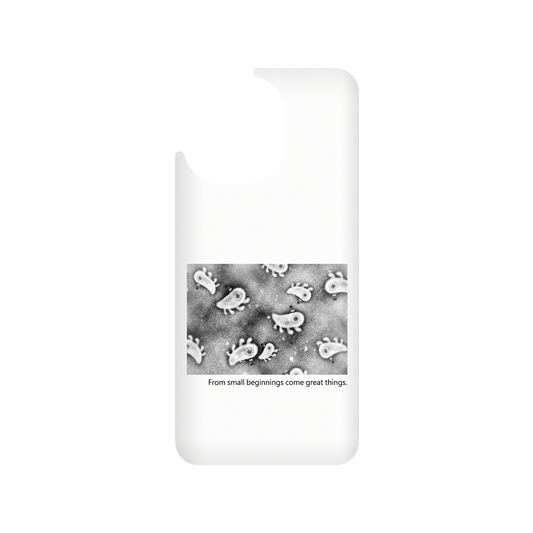 RHINOSHIELD X Incrediville  SolidSuit Xiaomi Mi 11 Case - Microscopic Observation - White