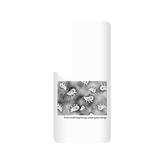 RHINOSHIELD X Incrediville  SolidSuit Xiaomi Mi 10 Case - Microscopic Observation - White