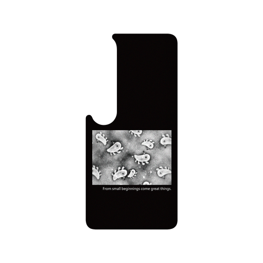 RHINOSHIELD X Incrediville  SolidSuit Xiaomi Mi 10 Case - Microscopic Observation - Black