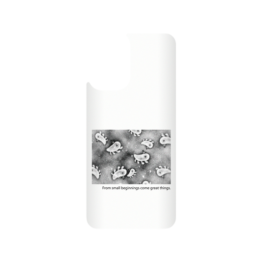 RHINOSHIELD X Incrediville  SolidSuit Redmi Note 10 (4G) Case - Microscopic Observation - White