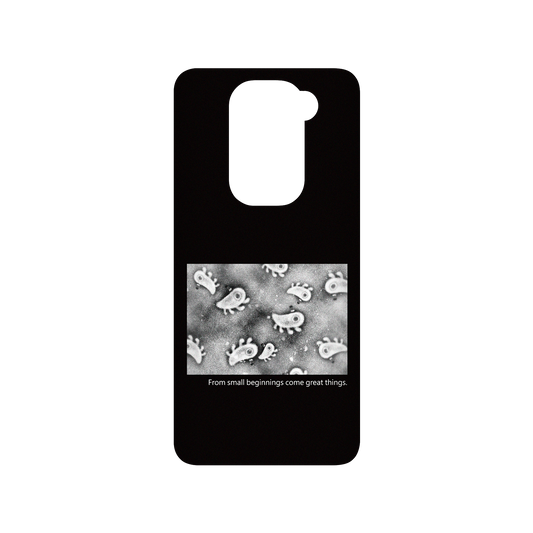 RHINOSHIELD X Incrediville  SolidSuit Redmi Note 9 (4G Global) Case - Microscopic Observation - Black
