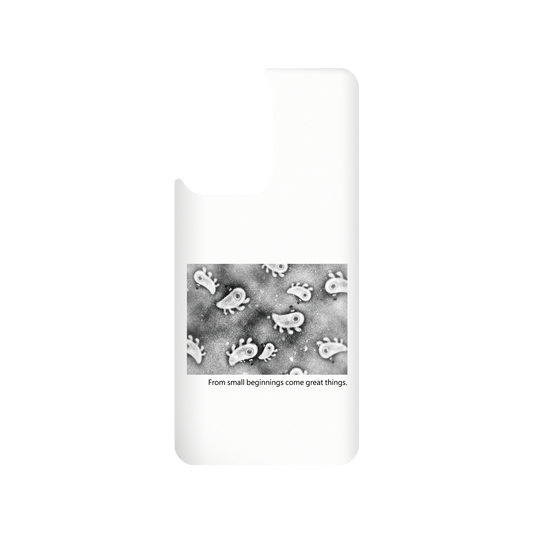 RHINOSHIELD X Incrediville  SolidSuit Xiaomi 11T Case - Microscopic Observation - White